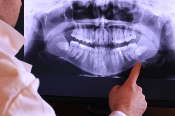 Best Tooth Pain Emergency Relief  in Drain, OR